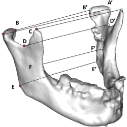 Condyle medial