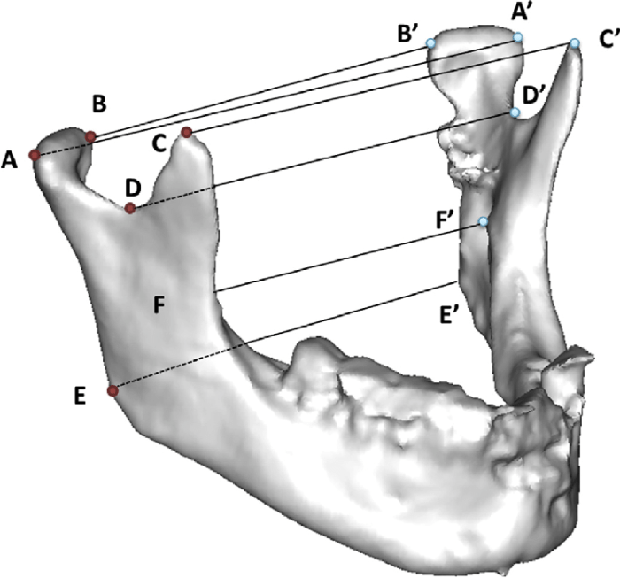 Condyle medial